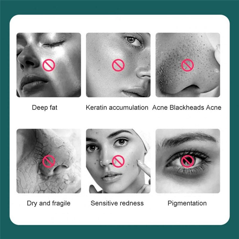 Cat Paw Facial Cleansing Machine